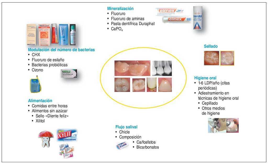 Caries Se Puede Prever Que Pacientes Necesitan Un Programa De Profilaxis Intensivo Quintessence