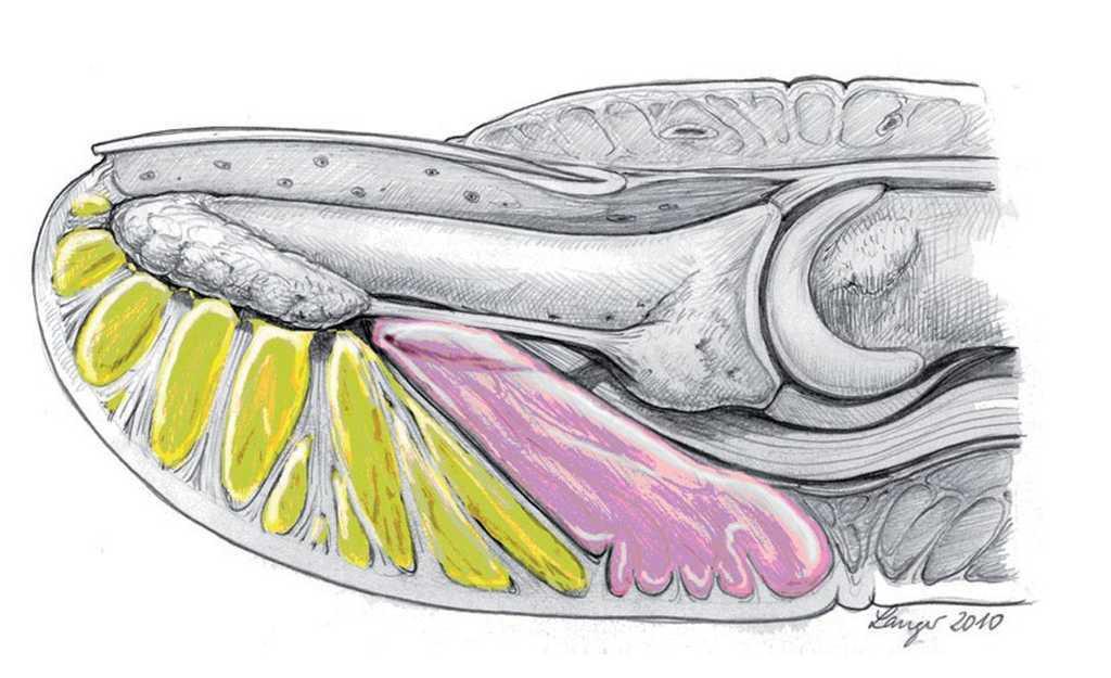 Infección del pulpejo. Panadizo Técnicas Quirúrgicas en Ortopedia y