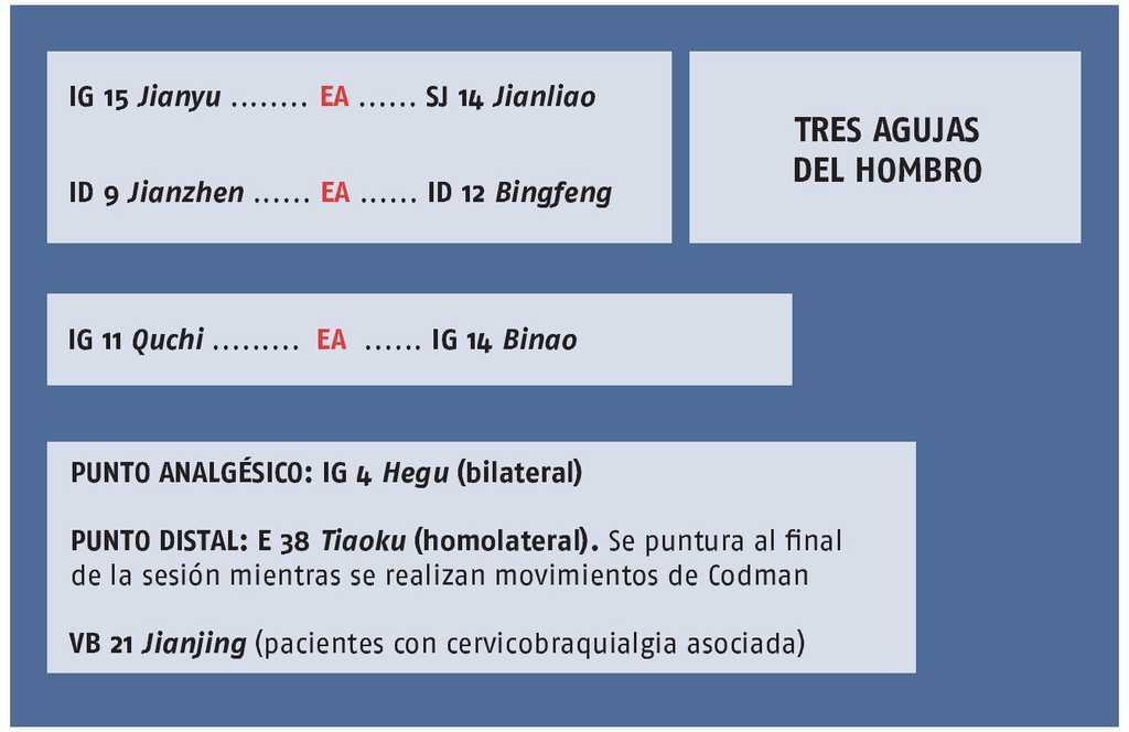 enlazar Tubería Cadera Electroacupuntura para el tratamiento del síndrome subacromial | Revista Internacional de Acupuntura enlazar Tubería Cadera Electroacupuntura para el tratamiento del síndrome subacromial | Revista Internacional de Acupuntura