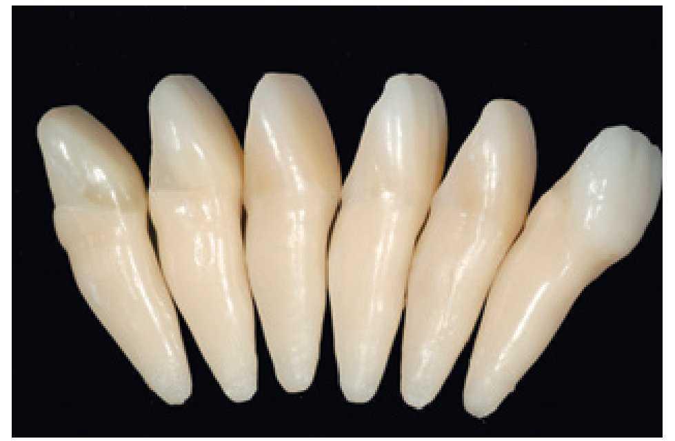 Composites en la clínica diaria cómo elegir el material correcto y simplificar las técnicas de