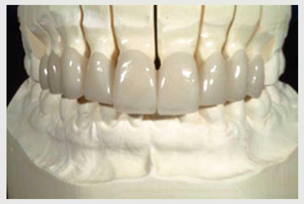 Insuficiente exposición dentaria en el sector anterior Presentación de