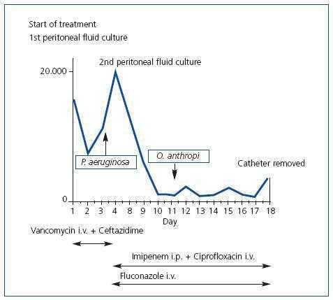 Ochrobactrum anthropi and polymicrobial peritonitis in peritoneal ...