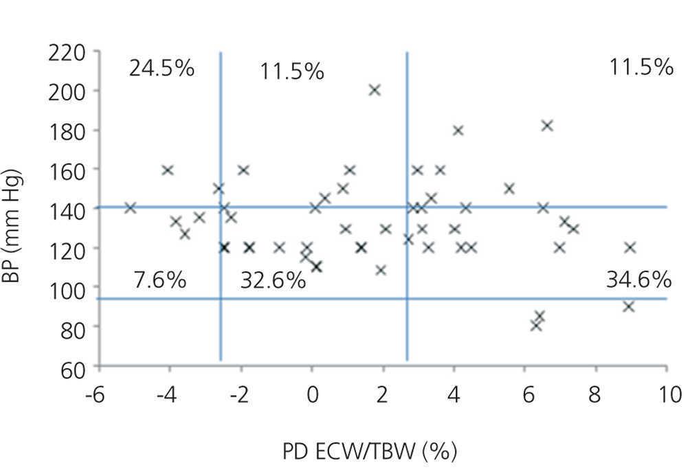 Echocardiographic impact of hydration status in dialysis patients