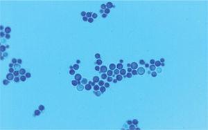 Levaduras de M. globosa en cultivo. Azul de lactofenol ×1.000.