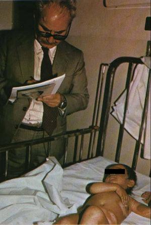 El Dr. Manuel Domínguez Carmona, miembro del equipo de inspectores de la ONU en la guerra Irán-Iraq, examina a una niña afectada por iperita en 1987. Cortesía del Dr. Shahriar Khateri.