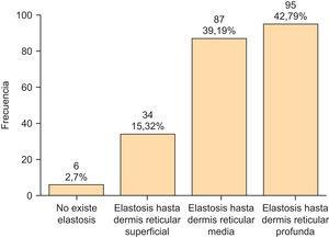 Elastosis solar observada en carcinomas espinocelulares.