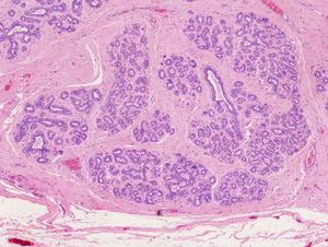 Imagen microscópica, detalle de los acinos y ductos del tejido mamario (HE100x).
