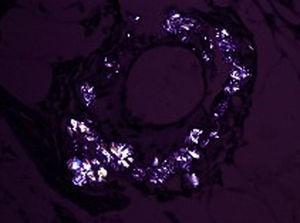 Con la birrefringencia se observan los característicos cristales espiculados del oxalato cálcico (luz polarizada ×300).