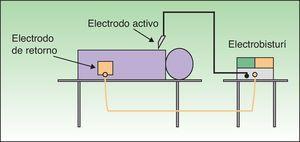 Circuito monopolar: consta de electrobisturí (generador), electrodo activo y electrodo de retorno. La electricidad fluye a través del paciente.