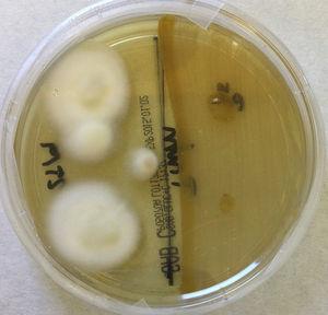Placa de agar Sabouraud dextrosa con cloranfenicol (SDA) inoculada con Trichophyton rubrum con y sin siembra previa de Pseudomonas aeruginosa, tras 12 días de incubación a 28°C.