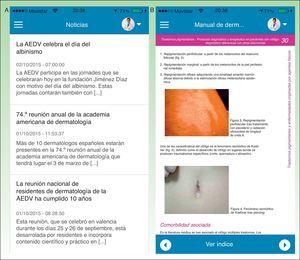 Imágenes de las secciones de la app de la AEDV: A) noticias y B) manual de dermatología.
