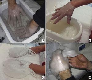 A) Introducir las manos en el dispositivo cuando la parafina ya sea líquida. B) Sacar la mano y repetir el procedimiento hasta que la parafina se mantenga en la mano como un guante. C) Envolver las manos en bolsas de plástico durante 15-20min. D) Retirar parafina.