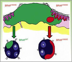 Heterogeneidad intratumoral. Presencia de subclones portadores de la mutación BRAFV600E en un tumor primario mayoritariamente BRAFWT.