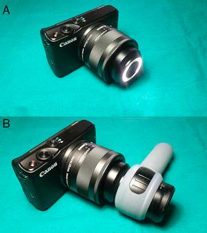 Objetivo Canon EF-M 28mm f/3,5 Macro IS STM. A)Obsérvese su sistema LED en la parte frontal del objetivo. B)El objetivo posibilita un fácil acoplamiento con el dermatoscopio.