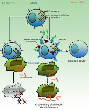 En ausencia de anti-FNT-α, las células T citotóxicas efectoras de memoria (TEMRA) liberan los gránulos con enzimas citolíticas (perforina, granulolisina) que destruyen los macrófagos infectados por M. tuberculosis así como los bacilos intra- y extracelulares. En presencia de anti-FNT-α, el FNT transmembrana de los TEMRA queda ligado a este anticuerpo, favoreciendo la apoptosis linfocitaria. La depleción de linfocitos T citotóxicos impide, por tanto, el control del crecimiento y permite la diseminación de M. tuberculosis. Fuente: Adaptado de Miller y Ernst.41.