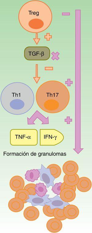 Formación de granulomas estériles en contexto de terapia anti-TNF-α. Los fármacos anti-TNF-α son parcialmente eficaces, en general, en las enfermedades granulomatosas como la enfermedad de Crohn o la sarcoidosis. Se sugiere que esto es debido a un desbalance secundario a su uso, con un incremento en la función de los linfocitos Th17. Dentro de estos fármacos, etanercept provoca reacciones granulomatosas con mayor frecuencia, de un lado por el bloqueo solo parcial del TNF-α y, del otro, por la falta de producción de TGF-β, lo cual permite una sobreproducción de IFN-γ y de TNF-α, esenciales en el desarrollo del granuloma aséptico. IFN: interferón; linfocito Th: linfocito T colaborador; linfocito Treg: linfocito T regulador; TGF: factor de crecimiento transformante; TNF: factor de necrosis tumoral.