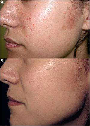 DERMATO - PCI 5p - Dermatologia