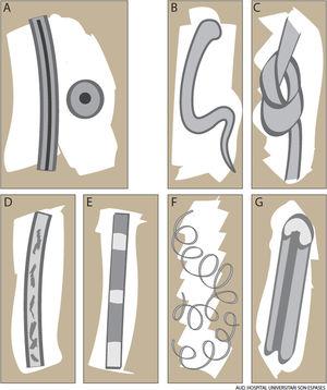 Claves diagnósticas en displasias pilosas II