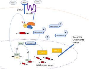 Esquema de la vía de activación de WNT, betacatenina y LEF-1 en neoplasias matricales. Adaptado de Tumminello y Hosler8.
