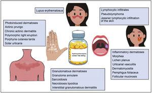 Hydroxychloroquine in dermatology.