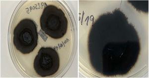 Macroscopic images of the microbiology culture. Note the characteristic black color and hairy surface of the colonies.