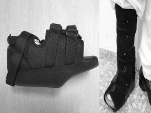 A) Zapato ortopédico con descarga de antepié utilizado en pacientes con pie de Charcot tipo I de Sanders. B) Ortesis de descarga plantar (CAM Walker®) utilizada en pacientes con pie de Charcot tipos II, II o IV de Sanders.