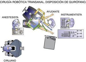 Cirugía robótica transanal. Disposición del quirófano.