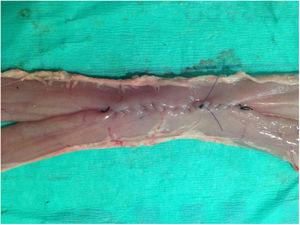 Anastomosis intestinal laterolateral manual con vísceras «ex vivo» porcinas.