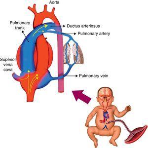 Fetal circulation.
