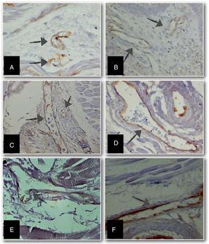 Micrographs of stillborn tongue fragments examined under light microscopy, showing the increase in anti-CD31 immunolabeled blood vessels (arrows) (objective 100×–3250× final magnification) at different gestational ages (GA). (A) GA: 23 weeks; (B) GA: 28 weeks; (C) GA: 34 weeks; (D) GA: 37 weeks; (E) GA: 39 weeks, and (F) GA: 40 weeks.