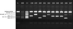 Agarose gel image (2%) highlighting the viewing standard of the results. Molecular Weight Marker (MB) corresponds to the pattern used in set B to identify 5 different species of viruses. In this case, 4 positive samples for RV A/B/C (159, 162, 166 and 167), 5 positive samples for RSV A (158, 161, 163, 164 and 165) and 2 positive samples for RSV B (160 and 166). Note: the sample 166 presented co-detection with RV A/B/C and RSV B.