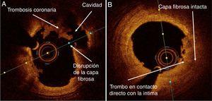 Utilidad De Técnicas De Imagen En La Valoración De La Enfermedad ...