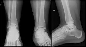 Comparative normal Radiography case 1.