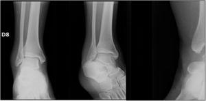 Clinical Case 3 Image. Unilateral fracture series.