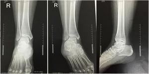Comparative normal Radiography case 4.