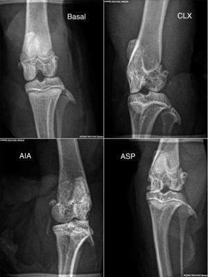 Radiografías en posición anteroposterior de los miembros de cada grupo (basal, CLX, AIA, ASP). Las mayores lesiones las presentó el grupo ASP, donde se observa cierto grado de deformación, erosión ósea, periostitis, estrechamiento del espacio articular, osteopenia y pérdida del contorno óseo.
