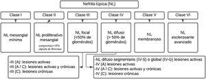 Clasificación de la nefritis lúpica. Adaptado de Weening et al.35.