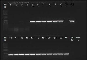 Electroforesis PCR gen blaKPC. Líneas 1-4: caso confirmado paciente 3 (sangre, hisopado rectal, secreción orotraqueal, secreción del sitio de inserción de marcapasos inguinal). Línea 5: caso confirmado paciente 1 (líquido peritoneal). Líneas 6-8: caso confirmado paciente 2 (secreción safenectomía, secreción orotraqueal, hisopado rectal). Líneas 9-11: pacientes colonizados. Líneas 12-16: muestras ambientales. Líneas 17-22: pacientes colonizados. DH5α: control negativo; KPC: control positivo; RX blanco: control de reactivos.