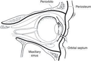 El septo orbitario es una extensión del tejido conectivo del periostio hacia los fondos de saco palpebrales. Fuente: con permiso de Shapiro et al.5.
