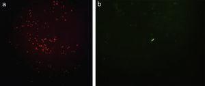 Fluorescent fast acid bacillum in Auramine-Rhodamine stain, (a) red and (b) green light (100×).