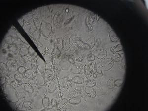 Visualización al microscopio de artroconidias (T. rubrum) en KOH a 10 aumentos (imágenes cedidas por cortesía de Luis Alou).