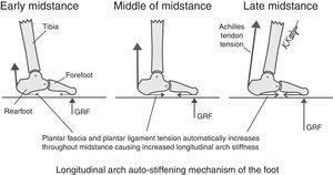 The longitudinal arch auto-stiffening mechanism is dependent on the unique anatomical arrangement of the Achilles tendon, plantar fascia and plantar ligaments within the human foot. In early midstance, the GRF plantar to the forefoot and Achilles tendon tension force is of relatively low magnitude which causes a relatively small amount of plantar fascia tension and plantar ligament tension which, in turn, causes little increase in longitudinal arch stiffness (left). By the middle of midstance, as Achilles tendon force and forefoot GRF increase, the longitudinal arch automatically stiffens due to the increase in passive tension force within the plantar fascia and plantar ligaments (middle). Just before heel-off, when Achilles tendon tension and GRF plantar to the forefoot are greatest, the longitudinal arch stiffness also automatically further increases in magnitude due to the increased passive plantar fascia and plantar ligament tension forces (right). The Longitudinal Arch Auto-Stiffening Mechanism greatly decreases the metabolic demand of walking and running activities since the automatic increase in longitudinal arch stiffness at the initiation of propulsion allows the power from the gastrocnemius and soleus muscles to be more efficiently transferred to the plantar forefoot through the Achilles tendon. As a result, the Longitudinal Arch Auto-Stiffening Mechanism results in less longitudinal arch flattening motion during late midstance and propulsion which improves the mechanical efficiency of gait.