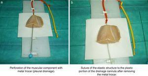 Performance of training model for ultrasound-guided vascular cannulation.