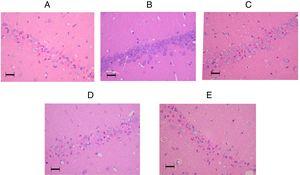 Representative pictures of the hippocampal CA1 regions in the amiodarone-treated animals and a sham-operated animal 7days after surgery. (A) 0mg/kg amodarone-treated animal; (B) Sham-operated animal; (C) 50mg/kg amodarone-treated animal; (D) 100mg/kg amodarone-treated animal; (E) 150mg/kg amodarone-treated animal. Images at magnification ×200. Bar=50μm.