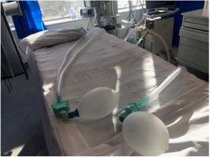 Heat and moisture exchanger (HME) filters were placed for each patient to provide heating and humidification as well as, a flow and pressure sensor and capnograh, at least in one of the two connections to increase the level of monitoring and safety.