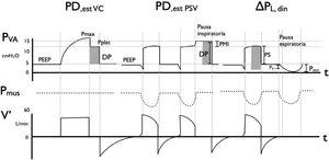 Métodos para medir la presión de distensión (PD) en modo controlado por volumen (PDest VC) y en modo presión de soporte: estático (PDest PSV) y dinámico (△PL,din). Representación de la curva de presión de vía aérea (Pav), de la presión muscular (Pmus) y del flujo en el tiempo. En modo VC con flujo constante, una pausa inspiratoria hace evidente la presión meseta o plateau (Pplat), que representa la presión de retroceso elástico del sistema respiratorio. Al no existir esfuerzo inspiratorio (Pmus=0), la diferencia entre Pplat y PEEP es la PD. La presión transpulmonar en PSV depende tanto de la PS como del componente de Pmus; una pausa inspiratoria permite hacer evidente este esfuerzo, al elevar la curva de presión a un valor mayor al configurado: esta es la Pplat y su diferencia con PEEP es PD. En el modo dinámico, la △PL,din se estima al sumar la presión de soporte (PS) a −2/3 presión de oclusión (6) (Pocc). Ambos métodos se correlacionan entre sí, siendo △PL,din siempre mayor (ya que incluye el componente resistivo del sistema respiratorio). Se representa, además, el PMI, que es Pplat – (PS+PEEP) y que es un indicador de trabajo inspiratorio y la P0,1, que es la presión medida en los primeros 100 milisegundos de la inspiración y que refleja la intensidad de la demanda del centro respiratorio. Nota: Pocc es siempre ≤ 0cm H2O (negativo con respecto a basal).