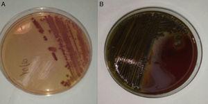 Colonias lactosa positivas en placa de agar-MacConkey (A) y de color gris oscuro, oxidasa positivas en la placa de agar-sangre (B), posteriormente identificadas como correspondientes a Vibrio cholerae no toxigénico.