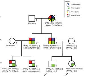 A three-generation family tree with clinical manifestations and observed SPTB and UMOD gene variants. Index patients are ilustrated with arrows.