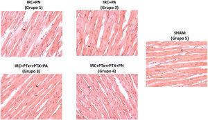 Imágenes representativas de la tinción de hematoxilina-eosina de los cardiomiocitos en cada grupo (aumentos 40x). IRC + PN (grupo 1), nefrectomía 7/8 con dieta normal en fósforo; IRC + PA (grupo 2), nefrectomía 7/8 con dieta alta en fósforo; IRC + PTxX + rPTH + PA (grupo 3), nefrectomía 7/8 con paratiroidectomía y dieta alta en fósforo; IRC + PTxX + rPTH + PA (grupo 4), nefrectomía 7/8 con paratiroidectomía y dieta normal en fósforo; SHAM (grupo 5), intervención simulada para nefrectomía y paratiroidectomía.