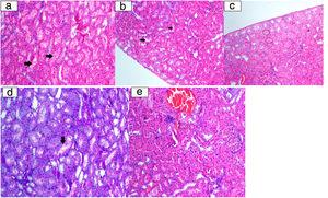 Histopathological examination image. a: Tubular epithelium lumen spill (arrow) (HE 200×); b: vacuolar degeneration in tubulepitel cells (arrow) (HE 200×); c: tubular epithelium necrosis (ring) (HE 200×); d: tubular epithelial cells degeneration at the brushy edge (arrow) (PAS 200×); e: eosinophilic cytoplasm cells (ring) with picnotic nuclei laying tubules (HE 200×).